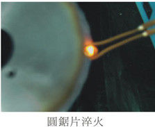 Ultrahoge frequentie 1-2Mhz inductie smeltapparatuur